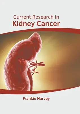 A veserák jelenlegi kutatása - Current Research in Kidney Cancer