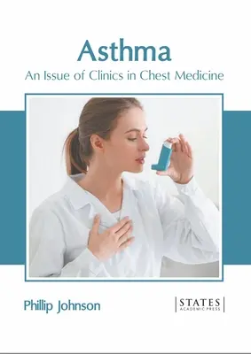 Asztma: A Klinika mellkasi orvostudományi klinikák száma - Asthma: An Issue of Clinics in Chest Medicine