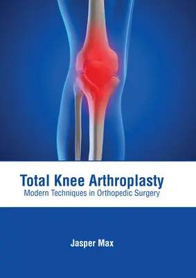 Teljes térdízületi műtét: Modern Techniques in Orthopedic Surgery (Modern technikák az ortopédiai sebészetben) - Total Knee Arthroplasty: Modern Techniques in Orthopedic Surgery