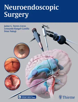 Neuroendoszkópos sebészet - Neuroendoscopic Surgery