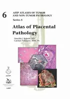 A méhlepény patológiájának atlasza - Atlas of Placental Pathology