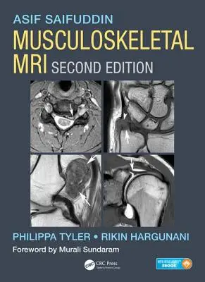 Mozgásszervi MRI - Musculoskeletal MRI
