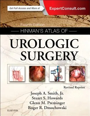 Hinman's Atlas of Urologic Surgery Revised Reprint (Az urológiai sebészet atlasza) - Hinman's Atlas of Urologic Surgery Revised Reprint