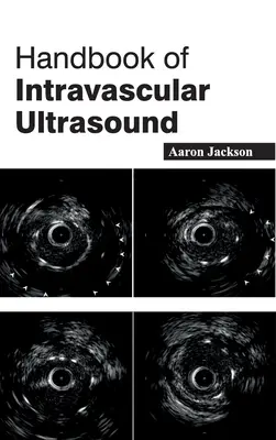 Az intravaszkuláris ultrahang kézikönyve - Handbook of Intravascular Ultrasound