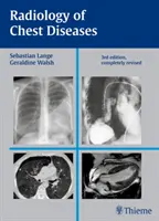 A mellkasi betegségek radiológiája - Radiology of Chest Diseases