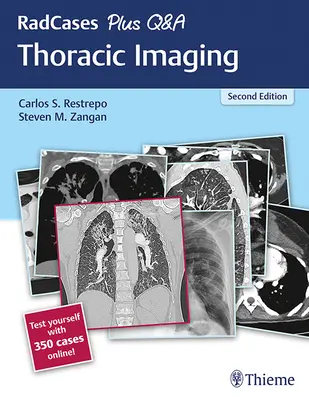 Radcases Plus Q&A Mellkasi képalkotás - Radcases Plus Q&A Thoracic Imaging