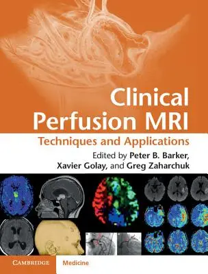 Klinikai perfúziós MRI: Technika és alkalmazások - Clinical Perfusion MRI: Techniques and Applications