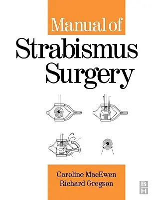 A kancsalsági sebészet kézikönyve - Manual of Strabismus Surgery