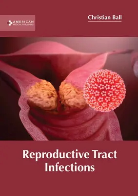 Reproduktív traktusfertőzések - Reproductive Tract Infections