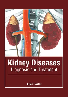 Vesebetegségek: Diagnózis és kezelés - Kidney Diseases: Diagnosis and Treatment