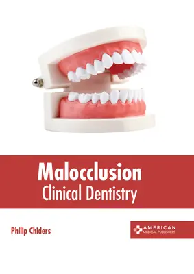 Malocclusion: Klinikai fogászat - Malocclusion: Clinical Dentistry