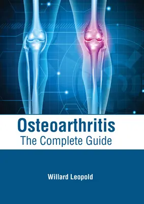 Osteoarthritis: A teljes útmutató - Osteoarthritis: The Complete Guide