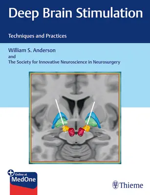 Mély agyi stimuláció: Technika és gyakorlatok - Deep Brain Stimulation: Techniques and Practices