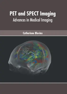 Háziállat és Spect Imaging: Advances in Medical Imaging - Pet and Spect Imaging: Advances in Medical Imaging