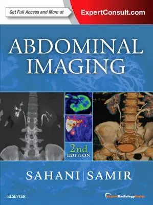 Hasi képalkotás: Radiológiai szakértői sorozat - Abdominal Imaging: Expert Radiology Series