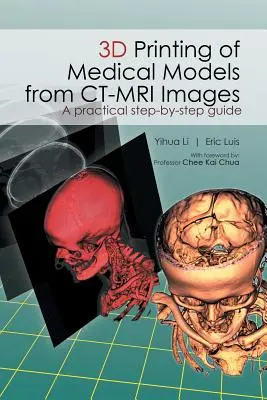 Orvosi modellek 3D nyomtatása CT-MRI-képekből: Gyakorlati útmutató lépésről lépésre - 3D Printing of Medical Models from CT-MRI Images: A Practical step-by-step guide