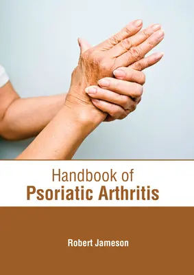 Az arthritis psoriatica kézikönyve - Handbook of Psoriatic Arthritis