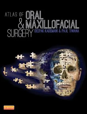 Atlas of Oral and Maxillofacial Surgery (A száj- és állcsont-, állkapocs- és arcsebészet atlasza) - Atlas of Oral and Maxillofacial Surgery