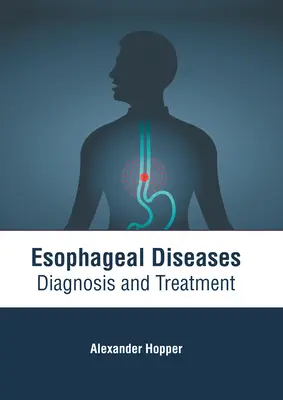 Nyelőcsőbetegségek: Diagnózis és kezelés - Esophageal Diseases: Diagnosis and Treatment