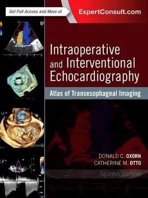 Intraoperatív és intervenciós echokardiográfia: A transzezofageális képalkotás atlasza - Intraoperative and Interventional Echocardiography: Atlas of Transesophageal Imaging