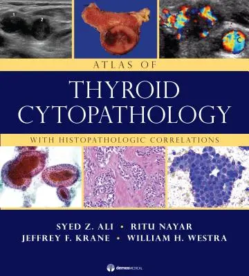 A pajzsmirigy citopatológia atlasza: Hisztopatológiai összefüggésekkel - Atlas of Thyroid Cytopathology: With Histopathologic Correlations