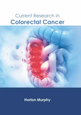 A vastagbélrák jelenlegi kutatása - Current Research in Colorectal Cancer