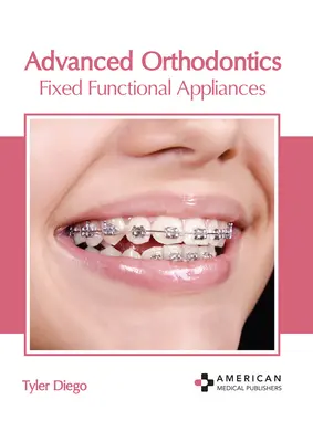 Haladó fogszabályozás: Rögzített funkcionális készülékek - Advanced Orthodontics: Fixed Functional Appliances