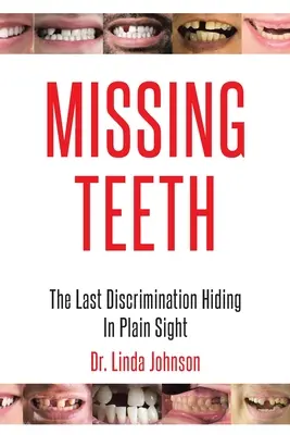 Hiányzó fogak: Az utolsó diszkrimináció, amely a szemünk előtt rejtőzik - Missing Teeth: The Last Discrimination Hiding in Plain Sight