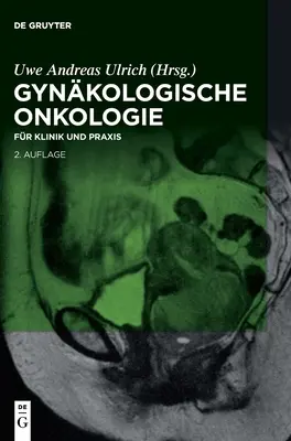 Gynkologische Onkologie