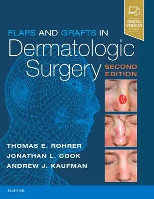 Lapok és transzplantációk a bőrgyógyászati sebészetben - Flaps and Grafts in Dermatologic Surgery