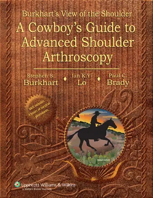 Burkhart véleménye a vállról - Egy cowboy útmutatója a fejlett vállartroszkópiához - Burkhart's View of the Shoulder - A Cowboy's Guide to Advanced Shoulder Arthroscopy