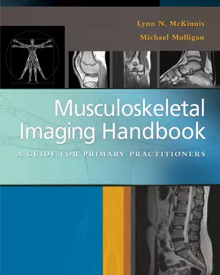 Izom- és csontrendszeri képalkotás kézikönyve: A Guide for Primary Practitioners - Musculoskeletal Imaging Handbook: A Guide for Primary Practitioners