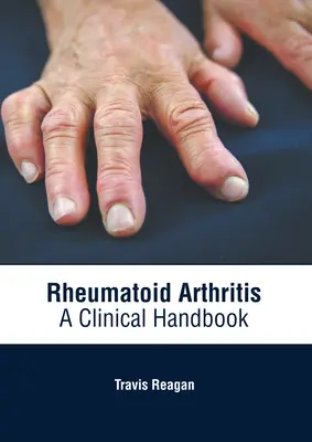 Rheumatoid arthritis: A Clinical Handbook - Rheumatoid Arthritis: A Clinical Handbook