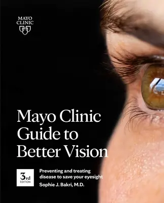 Mayo Clinic Guide to Better Vision (3. kiadás): A betegségek megelőzése és kezelése a látás megmentése érdekében - Mayo Clinic Guide to Better Vision (3rd Edition): Preventing and Treating Disease to Save Your Eyesight