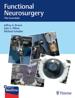 Funkcionális idegsebészet: Az alapvető ismeretek - Functional Neurosurgery: The Essentials