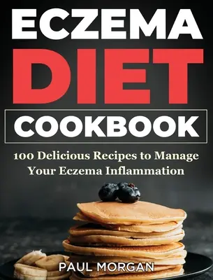 Ekcéma DIet szakácskönyv: 100 finom recept az ekcémás gyulladás kezeléséhez - Eczema DIet Cookbook: 100 Delicious Recipes to Manage your Eczema Inflammation