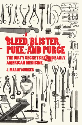 Vérzés, hólyagok, hányás és tisztálkodás: A korai amerikai orvoslás piszkos titkai - Bleed, Blister, Puke, and Purge: The Dirty Secrets Behind Early American Medicine