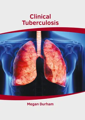 Klinikai tuberkulózis - Clinical Tuberculosis