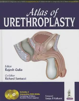 Az uretroplastika atlasza - Atlas of Urethroplasty