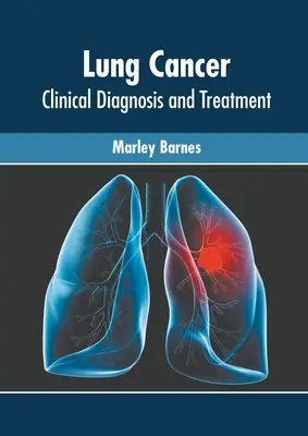 Tüdőrák: Klinikai diagnózis és kezelés - Lung Cancer: Clinical Diagnosis and Treatment