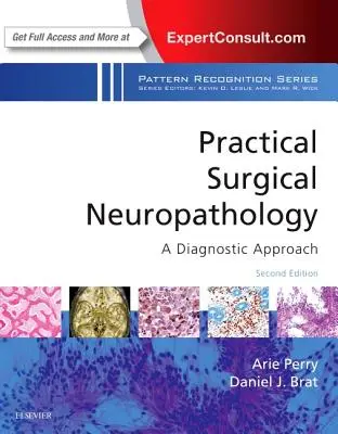 Gyakorlati sebészeti neuropatológia: A Diagnostic Approach: A Pattern Recognition sorozat egy kötete - Practical Surgical Neuropathology: A Diagnostic Approach: A Volume in the Pattern Recognition Series