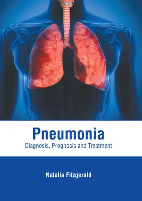 Pneumonia: Diagnózis, prognózis és kezelés - Pneumonia: Diagnosis, Prognosis and Treatment