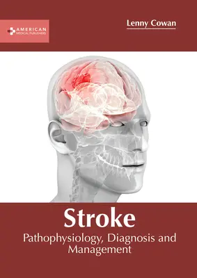 Stroke: Patofiziológia, diagnózis és kezelés - Stroke: Pathophysiology, Diagnosis and Management