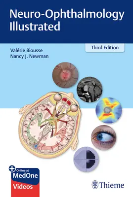 Neuroszemészet illusztrálva - Neuro-Ophthalmology Illustrated