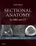 Metszeti anatómia MRI és CT segítségével - Sectional Anatomy by MRI and CT