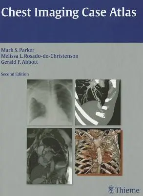 Mellkasi képalkotó esetatlasz - Chest Imaging Case Atlas