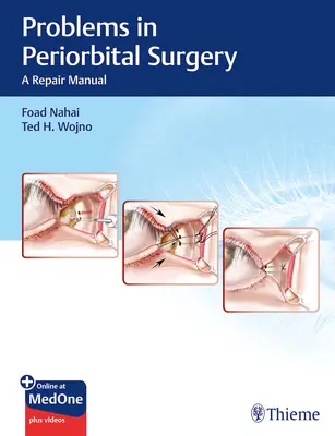 A szemkörnyéki sebészet problémái: A Repair Manual - Problems in Periorbital Surgery: A Repair Manual