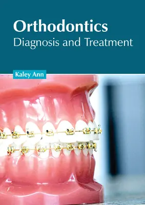 Fogszabályozás: Fogszabályozás: Diagnózis és kezelés - Orthodontics: Diagnosis and Treatment