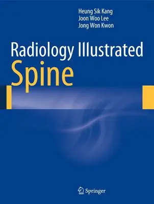 Radiológia illusztrálva: Gerinc - Radiology Illustrated: Spine