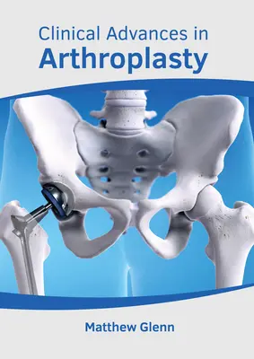 Klinikai előrelépések az ízületi protézisek terén - Clinical Advances in Arthroplasty